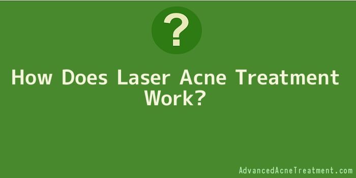 How Does Laser Acne Treatment Work