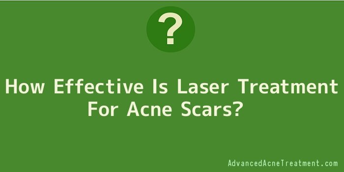 How Effective Is Laser Treatment For Acne Scars
