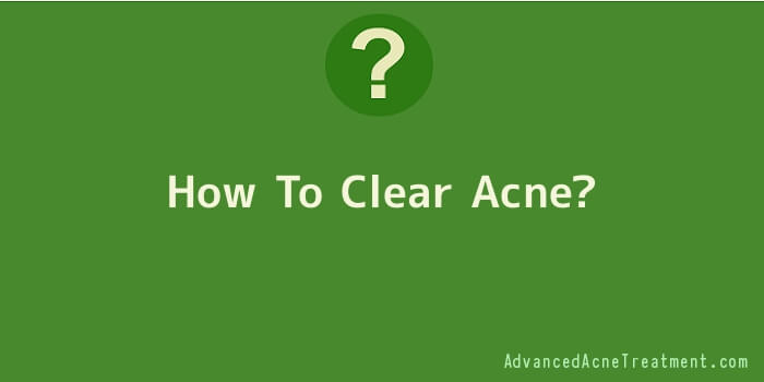 How To Clear Acne