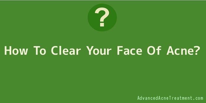 How To Clear Your Face Of Acne