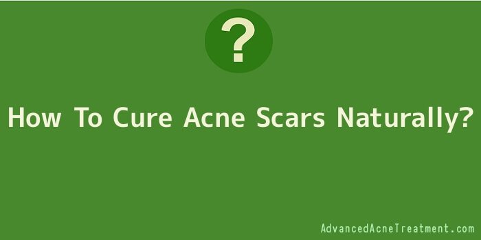 How To Cure Acne Scars Naturally
