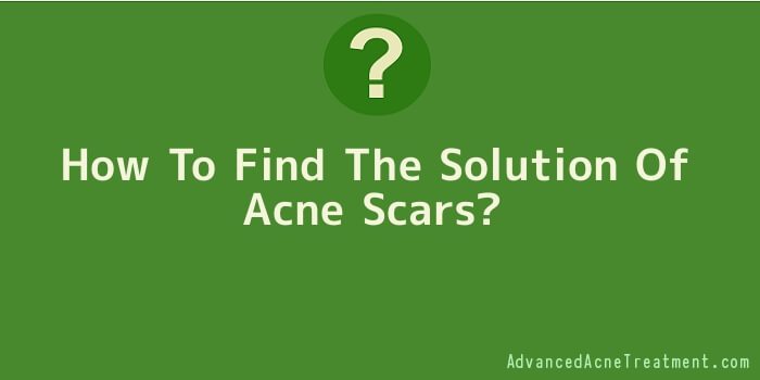 How To Find The Solution Of Acne Scars