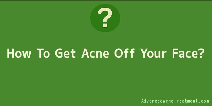 How To Get Acne Off Your Face