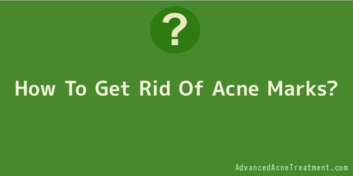 How To Get Rid Of Acne Marks?