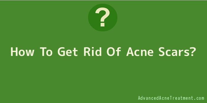How To Get Rid Of Acne Scars