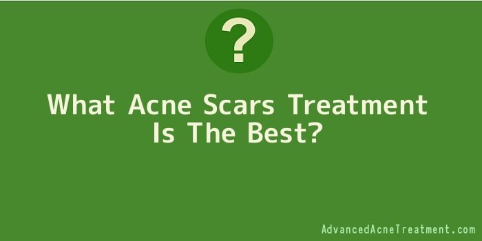 What Acne Scars Treatment Is The Best