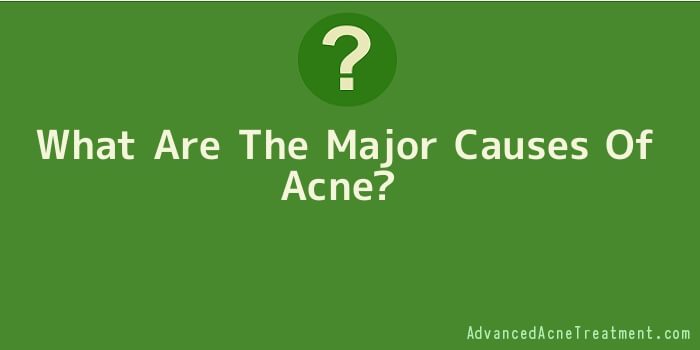 What Are The Major Causes Of Acne