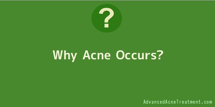 Why Acne Occurs