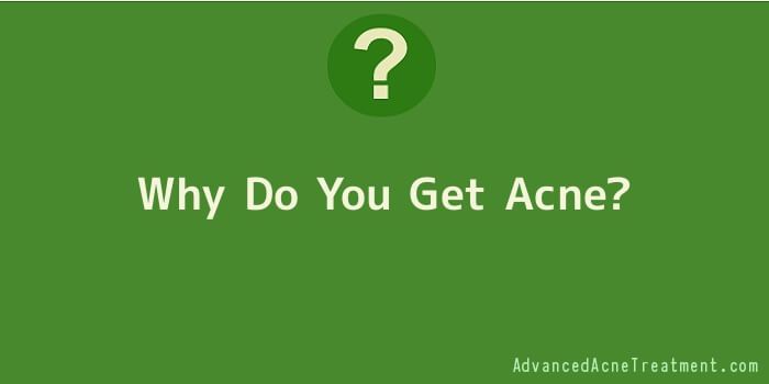 Why Do You Get Acne