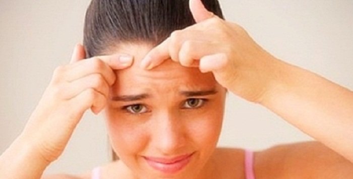 Stop Acne Breakouts