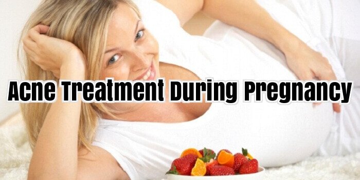 Acne Treatment During Pregnancy