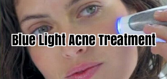 Blue Light Acne Treatment