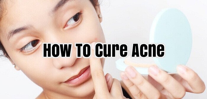How To Cure Acne