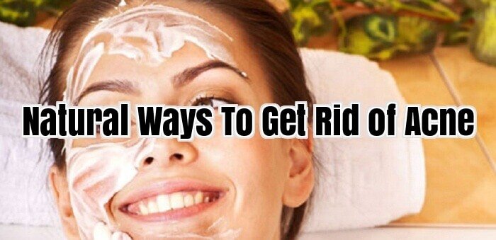 Natural Ways To Get Rid of Acne