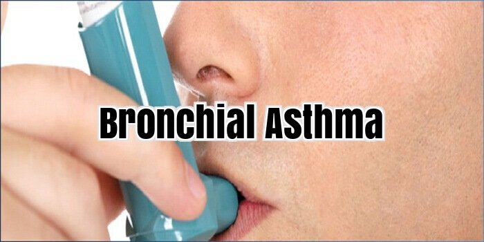 Bronchial Asthma
