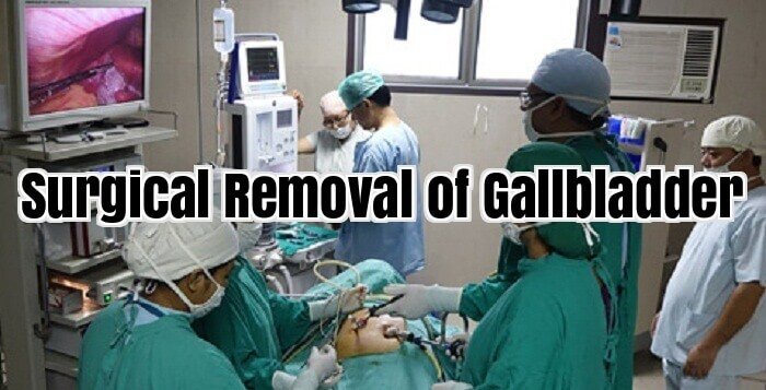 Surgical Removal of Gallbladder
