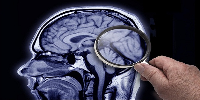 Why Fats Are The Building Blocks Of Brain?