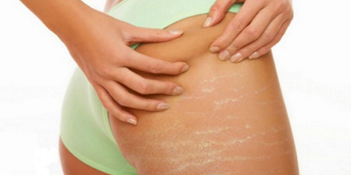 Are Cellulite Creams Really Effective