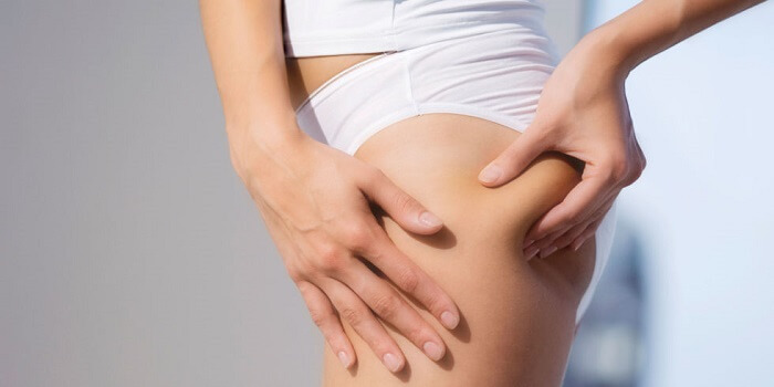 Why Cellulite Lotion Is A Perfect