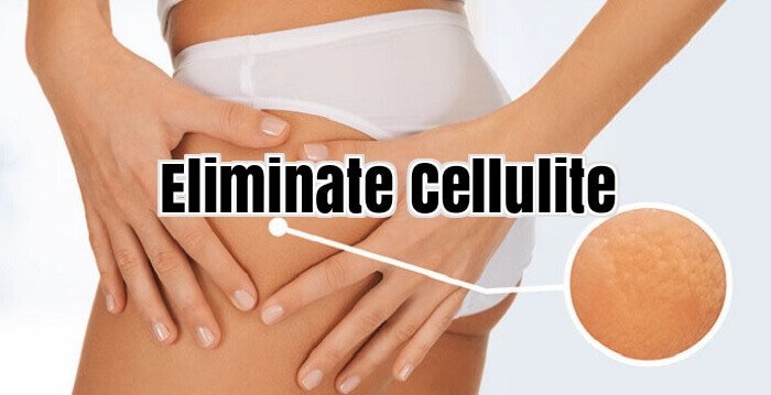 Eliminate Cellulite
