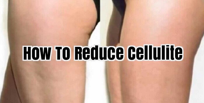 How To Reduce Cellulite