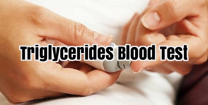Triglycerides Blood Test