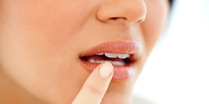 Cold Sore Prevention
