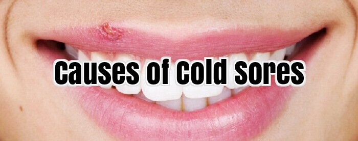 Causes of Cold Sores