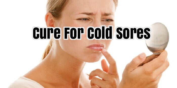 Cure For Cold Sores