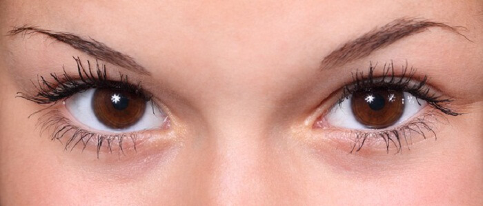 Questions And Answers On Using Eye Cream For Dark Circles Under Eyes