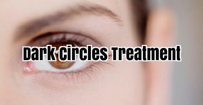 Dark Circles Treatment