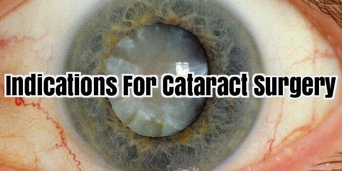 Indications For Cataract Surgery