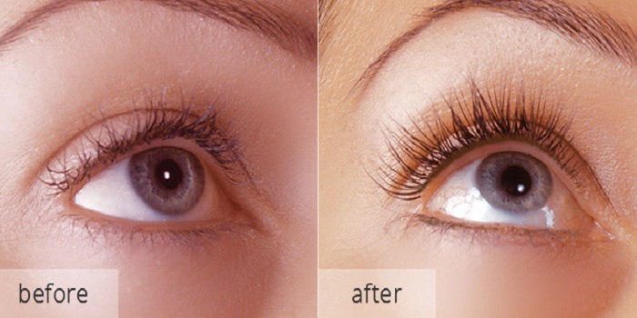 Eyelashes After Enhancement Treatment
