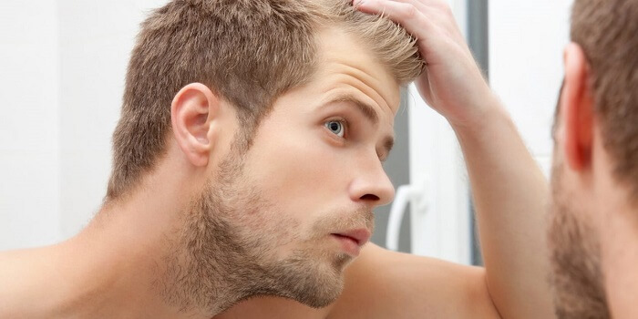 Best Hair Loss Treatments