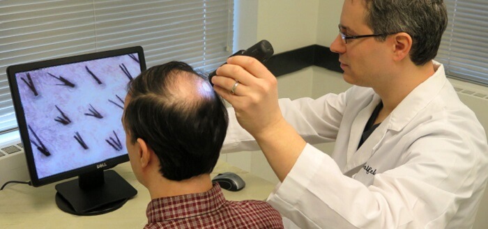 Diagnostic Tests For Hair Loss