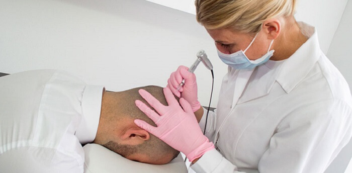 Different Hair Loss Treatments That Are Effective