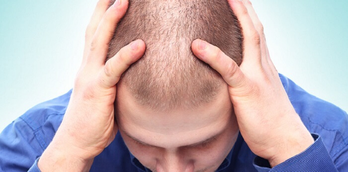 Hair Loss Specific Treatment