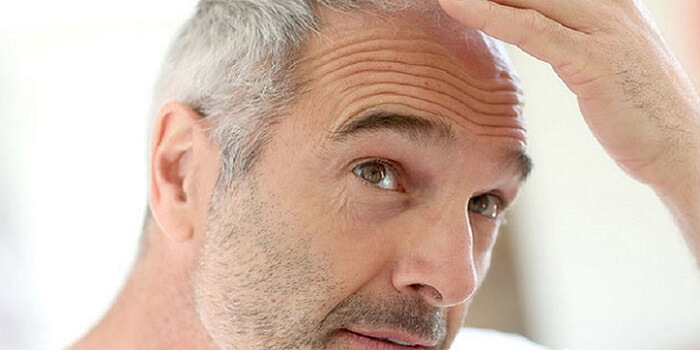 Boost Your Self Confidence With Latest Hair Transplant Treatments