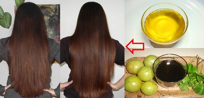 Herbal Remedies For Hair Regrowth