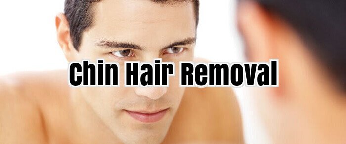 Chin Hair Removal