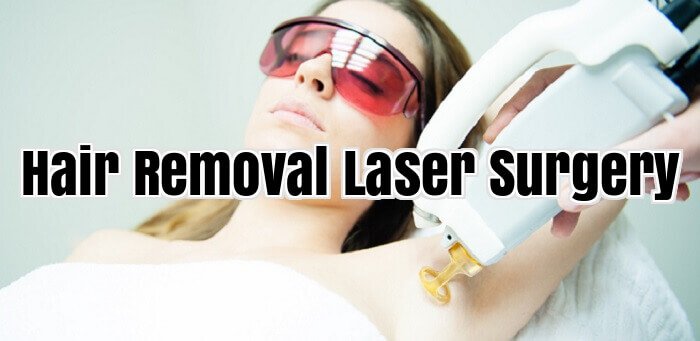 Hair Removal Laser Surgery