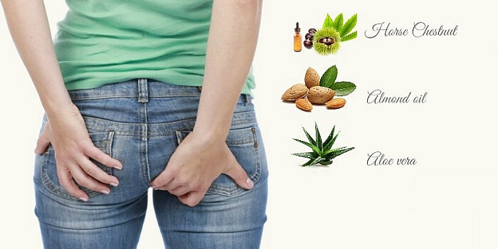 Natural Hemorrhoids Treatment