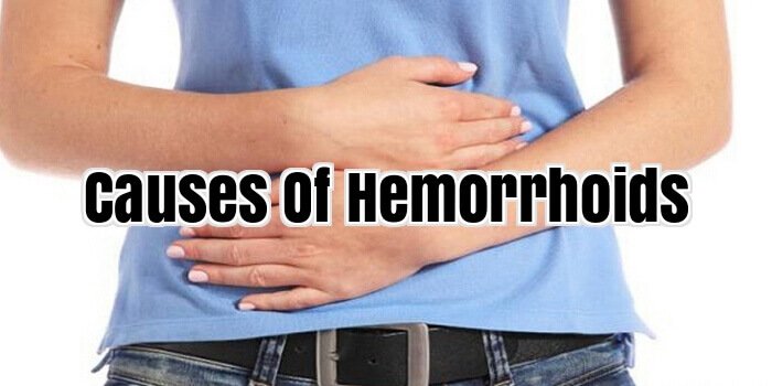 Causes Of Hemorrhoids