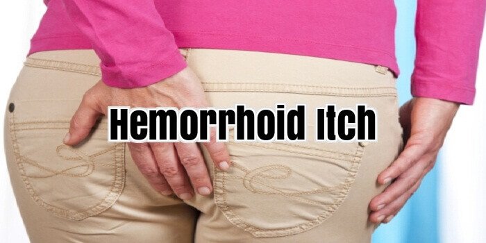 Hemorrhoid Itch