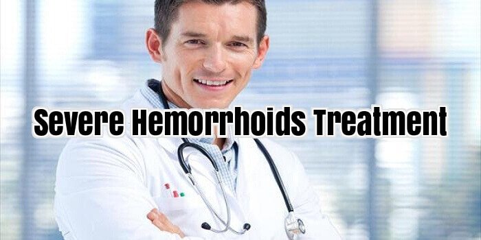 Severe Hemorrhoids Treatment