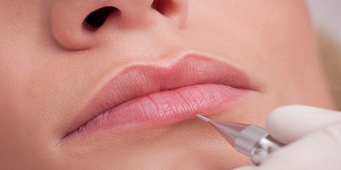 What Are The Best Solutions For Fuller Lips?