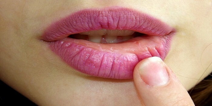 The Best Lip Plumper - Choose the Best Lip Plumper For You