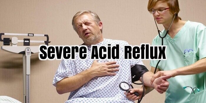 Severe Acid Reflux