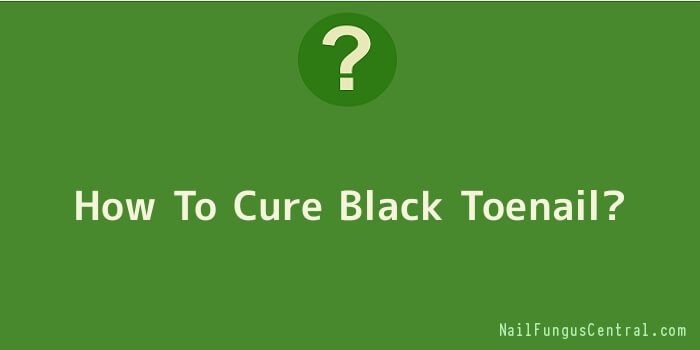How To Cure Black Toenail