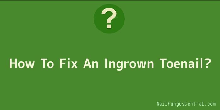 How To Fix An Ingrown Toenail